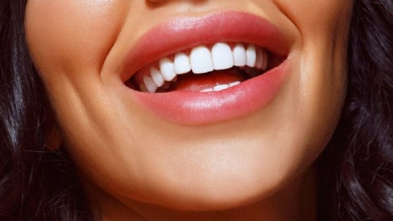When your teeth should be whitened?
